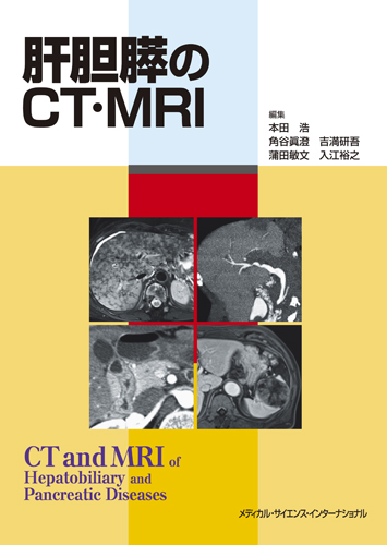 わかる! 画像診断の要点シリーズ6 わかる! 消化器 画像診断の要点 (わかる!画像診断の要点シリーズ) 大友 邦