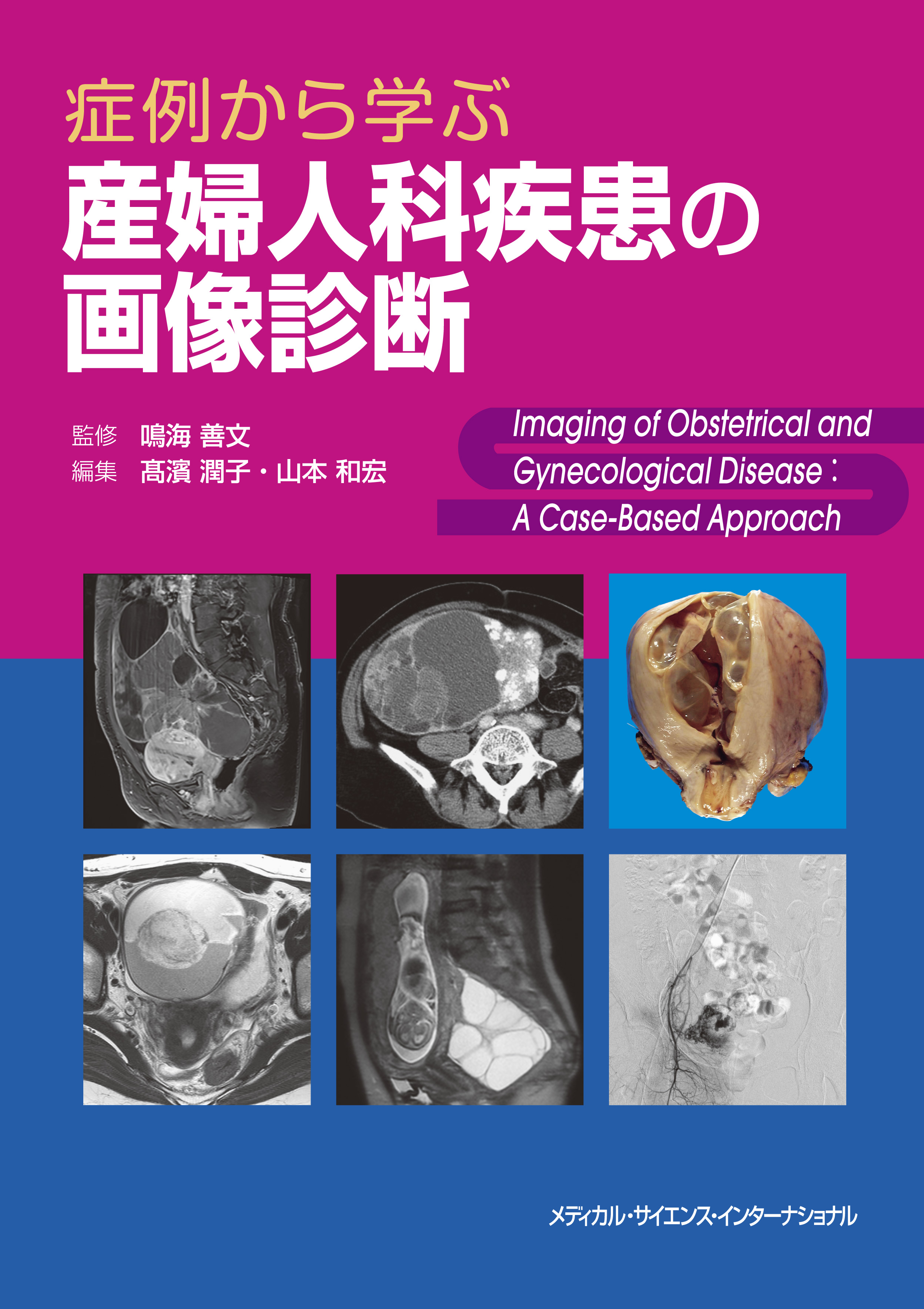Medsi 株式会社 メディカル サイエンス インターナショナル 症例から学ぶ産婦人科疾患の画像診断