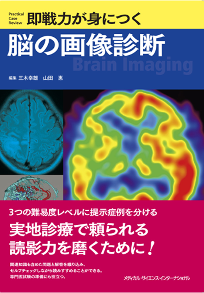 画像診断のための脳解剖と機能系