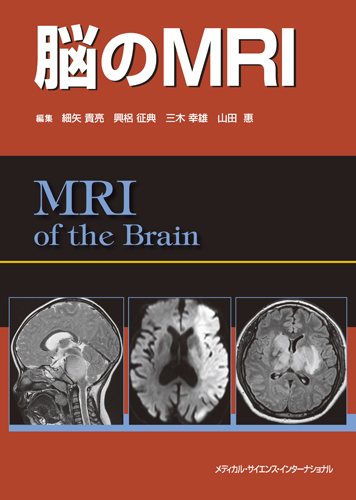 脳MRI 2 代謝・脱髄・変性・外傷・他