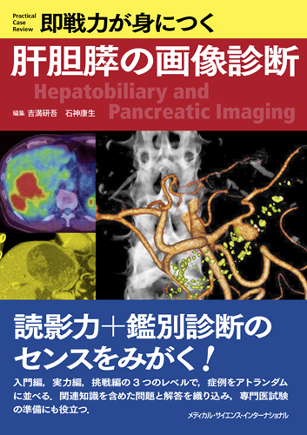 即戦力が身につく肝胆膵の画像診断-