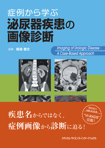 ケースレビュー核医学診断