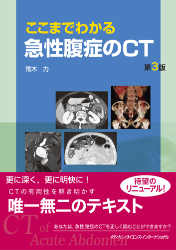 MEDSi)株式会社 メディカル・サイエンス・インターナショナル 